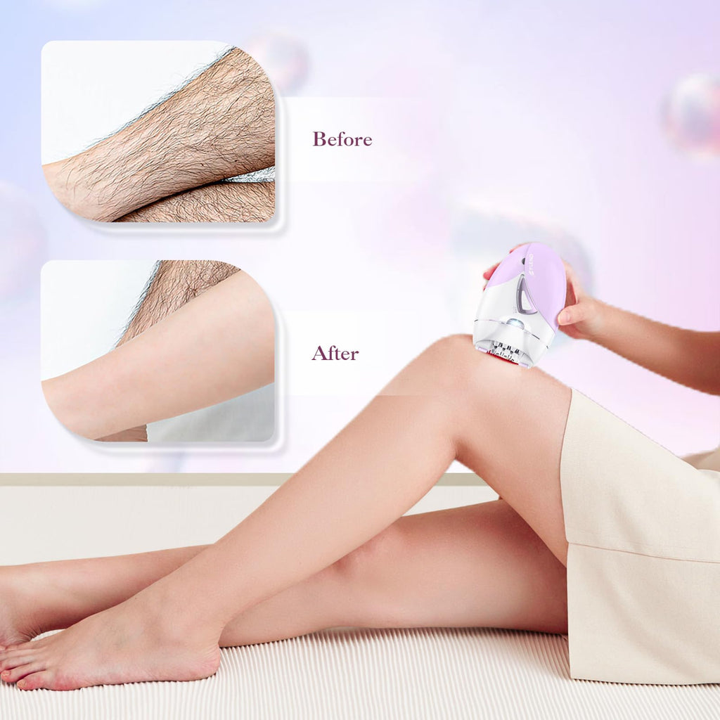2-Speed Adjustable Epilator with 36 Tweezers Y5759